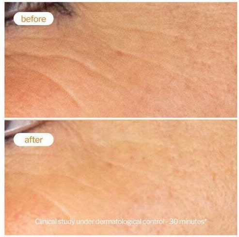 Novexpert Anti-aging Serum Booster for Face with Vitamin C for Detoxifying & Brightening 10ml