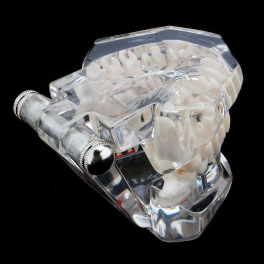 Dental Demonstration Model Ubx Mobilizable Teeth Implants Restorations Dental Pathologi