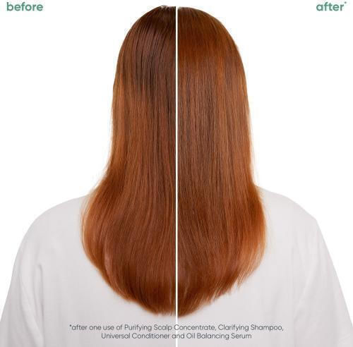Matrix Scalp Sync Oil Balancing Serum κατά της Λιπαρότητας 50ml