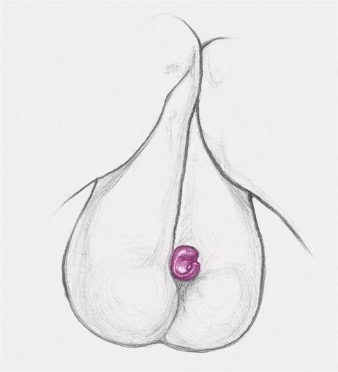 Fun Toys Gring Xl Finger Vibrator Sweet Raspberry Δονητής Δακτύλου Μωβ
