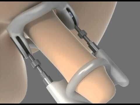 Jes Extender Light Standard Extensor Penis Alb