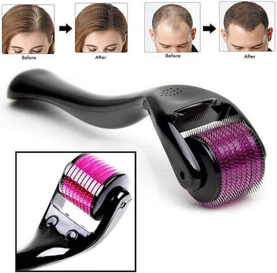 System Derma Roller 540 ace 0.5mm pentru Anti-Îmbătrânire