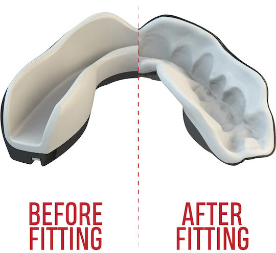 "extro Fangz Dental Prosthesis Black Junior"