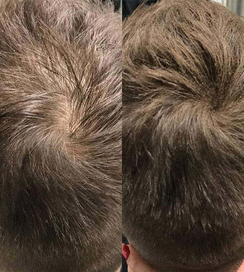 Beaver Fasern zur Abdeckung von Haarausdünnung mit Keratin Building 12gr