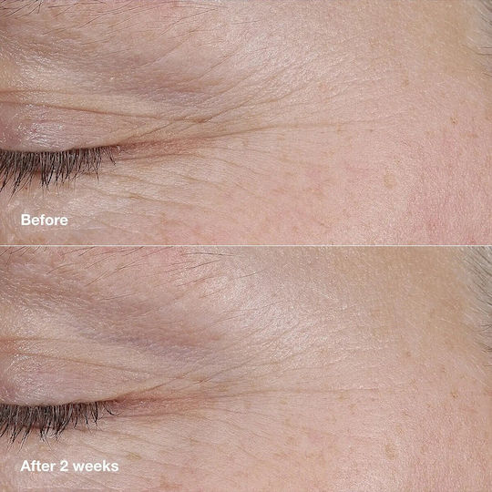 Clinique Smart Clinical Repair Balm Ματιών για Ενυδάτωση 3gr