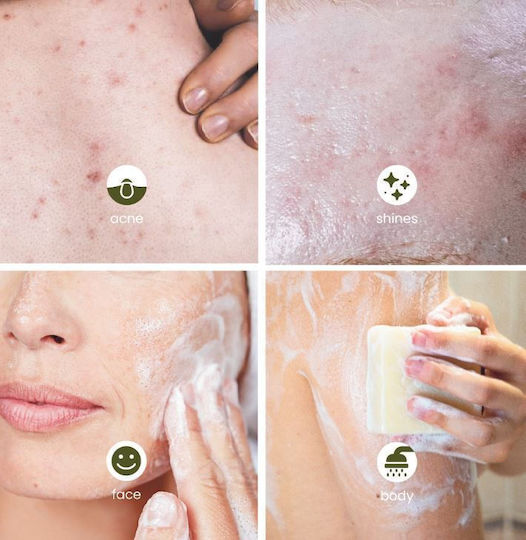Essabo Oily Skin Organic Soap 120gr