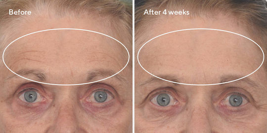 Murad Retinal Resculpt Overnight Treatment Ενυδατική & Αναπλαστική Κρέμα Προσώπου Νυκτός με Ρετινάλη 30ml