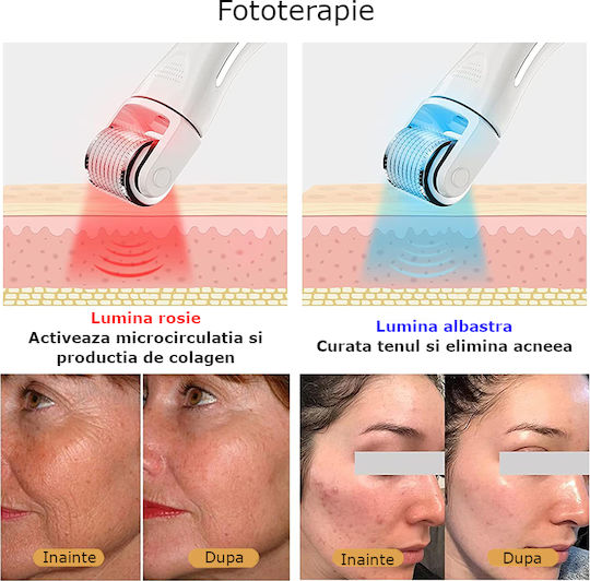 Gesichtspflegegeräte Lichttherapiegerät