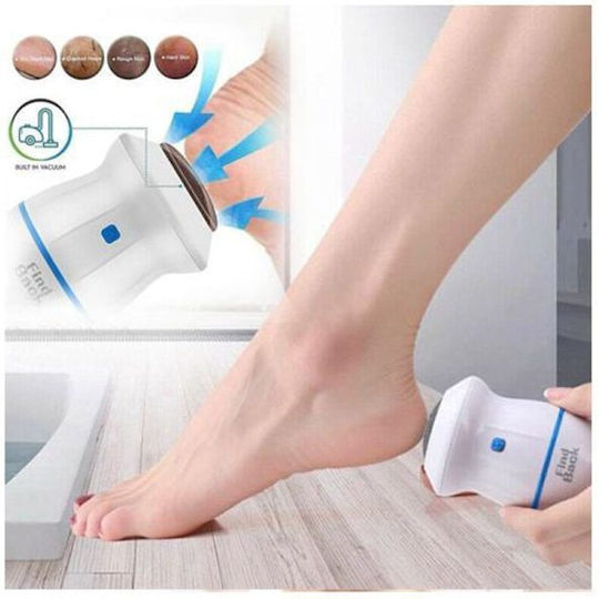 Callus Remover