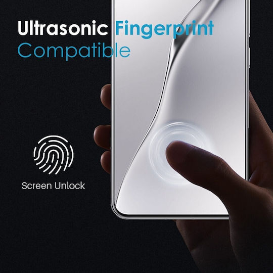 Tempered Glass (Xiaomi 15)