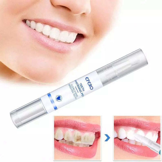 Teeth Whitening Kit with Pen & Device 5ml