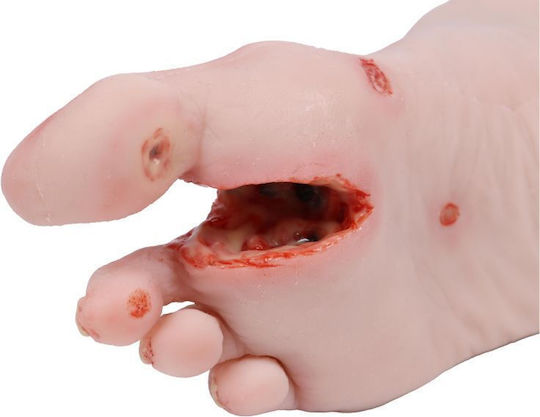 Training Manikin "Diabetic Foot Actinic Resection" Erler Zimmer