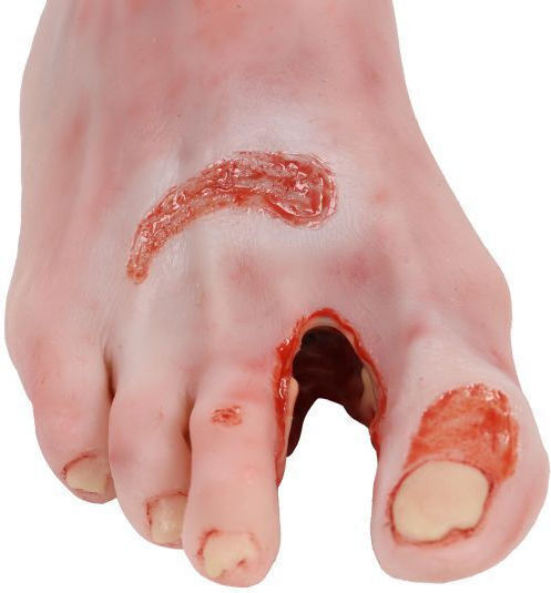 Training Manikin "Diabetic Foot Actinic Resection" Erler Zimmer