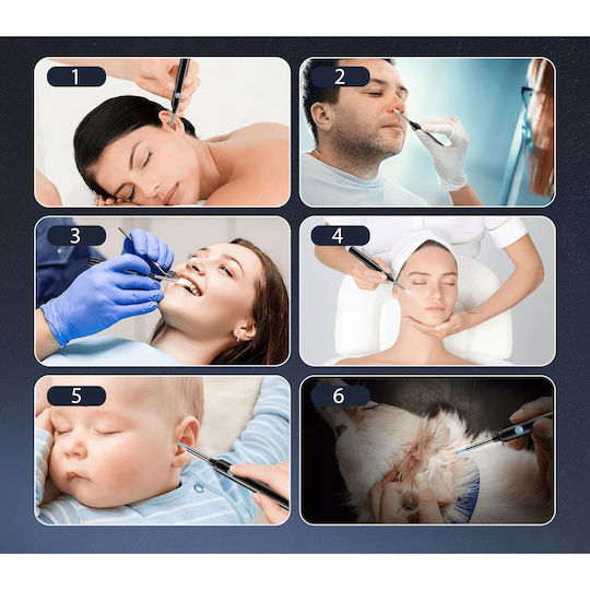 Ear Cleaning Device Otoscope Newevo Full Hd Camera 1080p 7-piece Earwax Removal Tool Kit 6 Led Lights Usb-c Charging Black