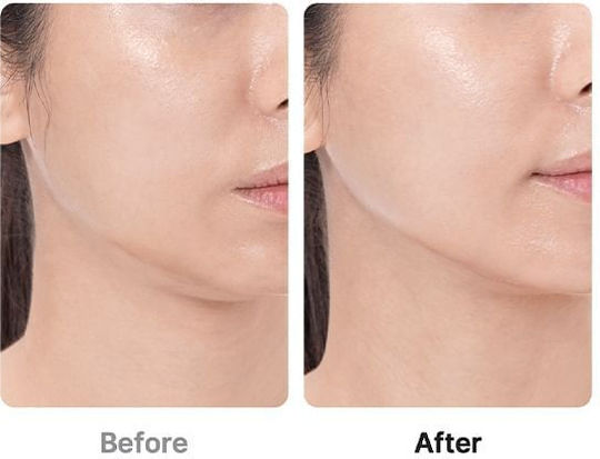 Medicube AGE-R Booster Pro Αnti-ageing / Firming / Pore Tightening Light Therapy Device Face LED Black