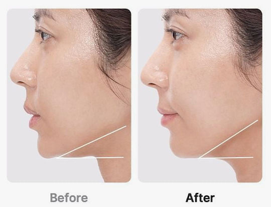 Medicube AGE-R Booster Pro Αnti-ageing / Firming / Pore Tightening Light Therapy Device Face LED Black