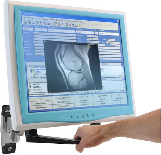 Ergotron Handle Kit