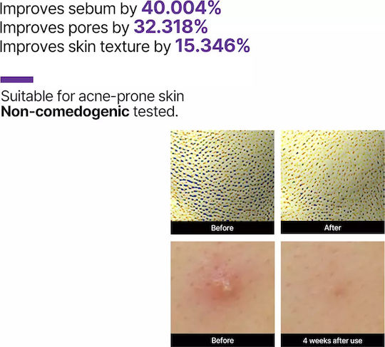 Some By Mi Retinol Intense Anti-aging Serum Face with Retinol 50ml