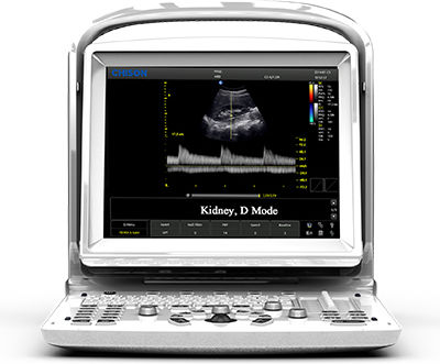 Chison ECO 3 Expert + Doppler Transrectal Array R7-A Συσκευή Φορητού Υπερήχου
