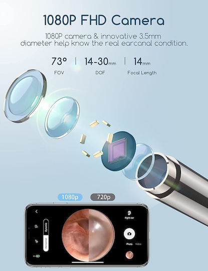 Wifi Otoscope 1080p Camera Led Light 360° Angle Usb-c Charging Ear Wax Cleaning Device Ip67 Waterproof iOS Android