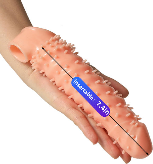 Massive Touch – Girth Expansion Sleeve Skin