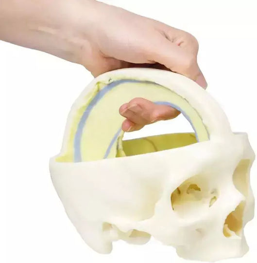 3D Schädel Harte Meningen Erler Zimmer