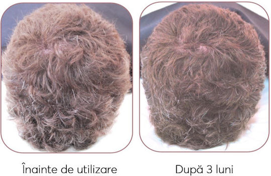 Ageless Clinic Treatment Plus Against Graying Loțiune de Păr împotriva Căderii Părului 210ml