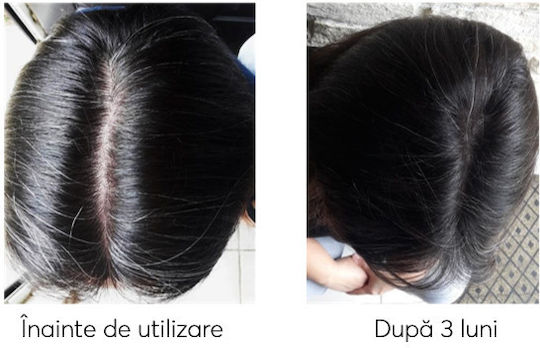 Ageless Clinic Treatment Plus Against Graying Loțiune de Păr împotriva Căderii Părului 210ml