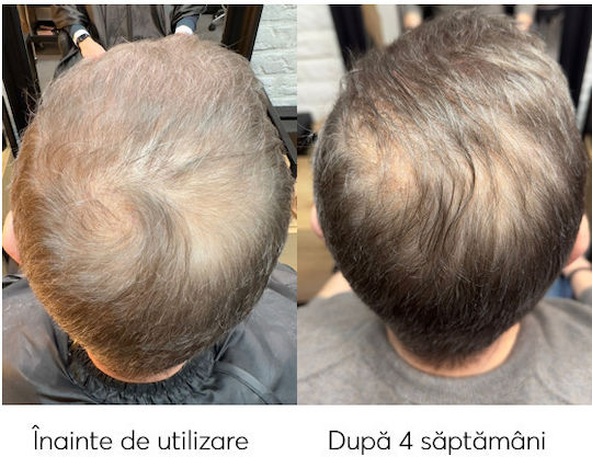 Ru:t hair Trial Seturi Pentru Par Tratamente Pentru Par Împotriva Căderii Părului Pentru Păr Vopsit Cu Șampon 3 Bucăți