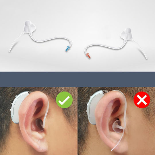 Digital Hearing Aid B0C77WFQSD