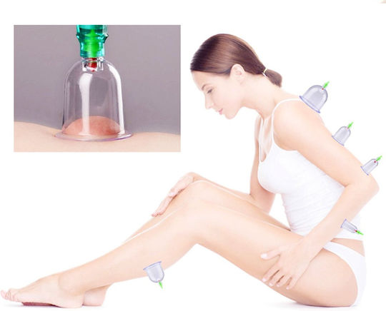 Chinesisches Vakuum Feuerlose Becher Set Pump Zellulitis Massage 12 Stück