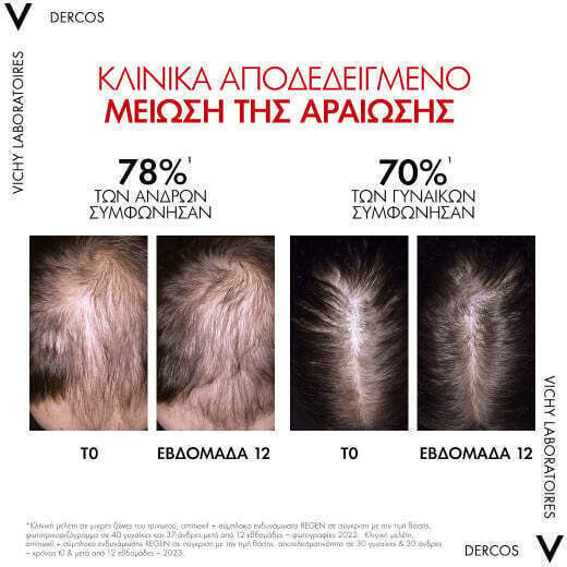 Vichy Dercos Serum Μαλλιών κατά της Τριχόπτωσης 90ml