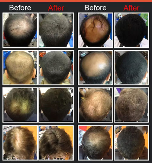 Sansiro Hair Building Fibers 25gr