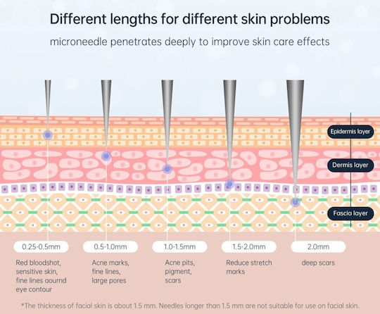Biopen Bio4 Dual Head Microneedling Device