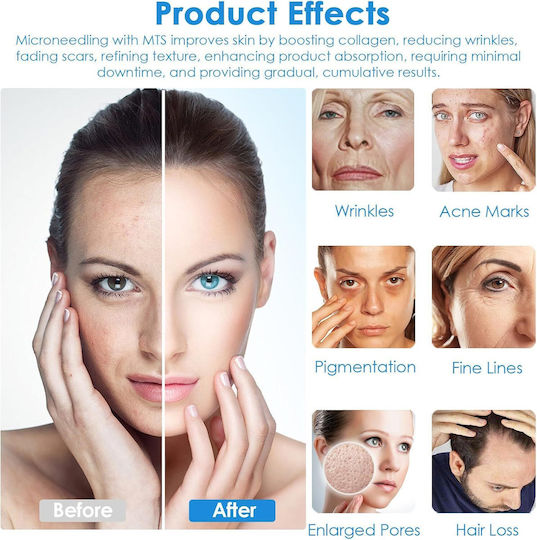 Ultima Mesotherapy Device