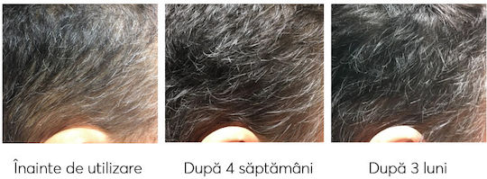 Ru:t hair Serum Pentru Scalp Împotriva Căderii Părului 100ml