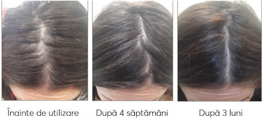 Ru:t hair Serum Pentru Scalp Împotriva Căderii Părului 100ml