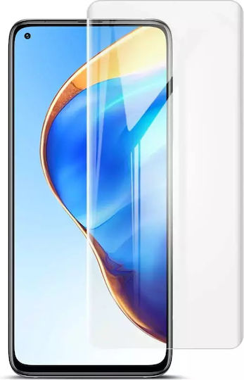 0.15мм Хидрогел Защитен екран 2бр (Xiaomi Mi 11 Lite / 11 Lite 5G / 11 Lite 5G NE)
