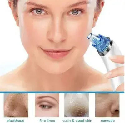 Dermasuction Συσκευή Περιποίησης Προσώπου για Καθαρισμό