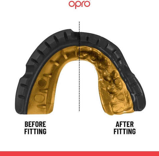 Μασέλα Opro Gold Σιδεράκια Black Gold