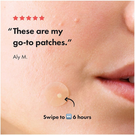 Hero Patches for Pimples Mighty Patch Original 24 Pieces