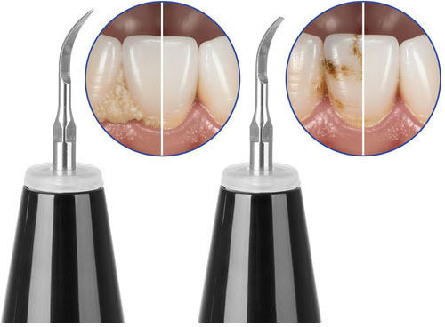 Portable Teeth Cleaning Device Rechargeable 5 Functions 3.5x18.8 Cm Soulima