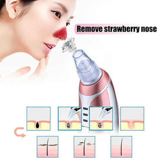 Kemei Black Spots Face Cleaning Device White KM-1867