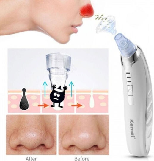 Kemei Black Spots Face Cleaning Device White KM-1867