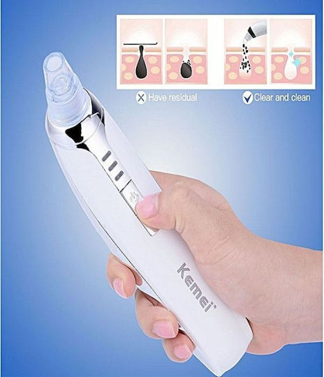 Kemei Black Spots Face Cleaning Device White KM-1867