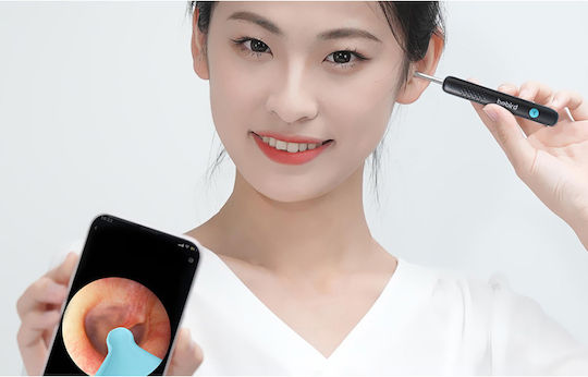 Bebird Smart Visual Rod Κάμερα Καθαρισμού Αυτιών 1τμχ
