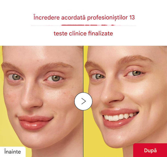 Eqqualberry Serum Hidratant pentru Față cu Vitamina C și Niacinamidă pentru Strălucire și Pete Pigmentare 30ml