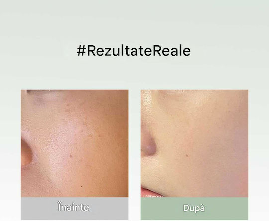 Arencia Mască Facială