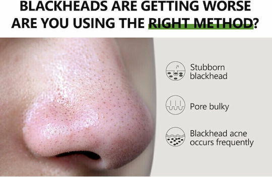 Vibrant Glamour Nose strips