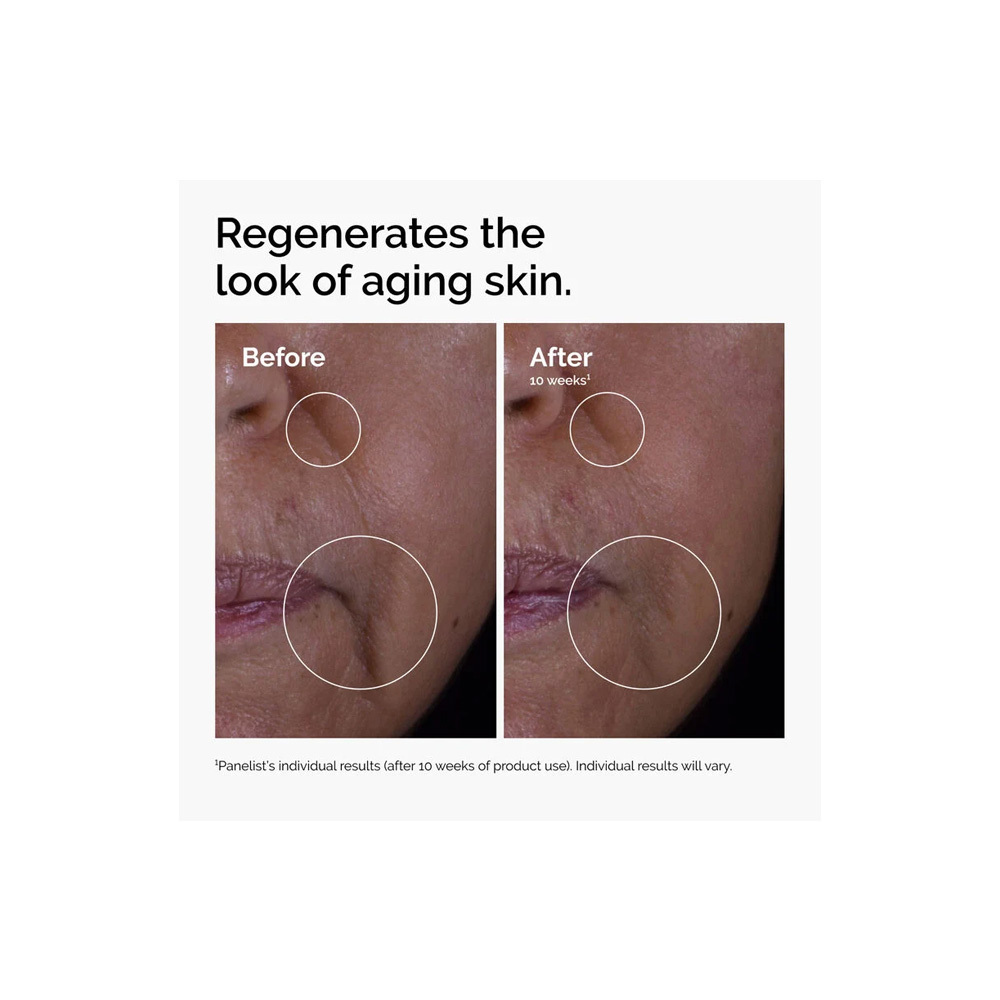 The Ordinary GF 15% Solution Αντιγηραντικό Serum Προσώπου 30ml